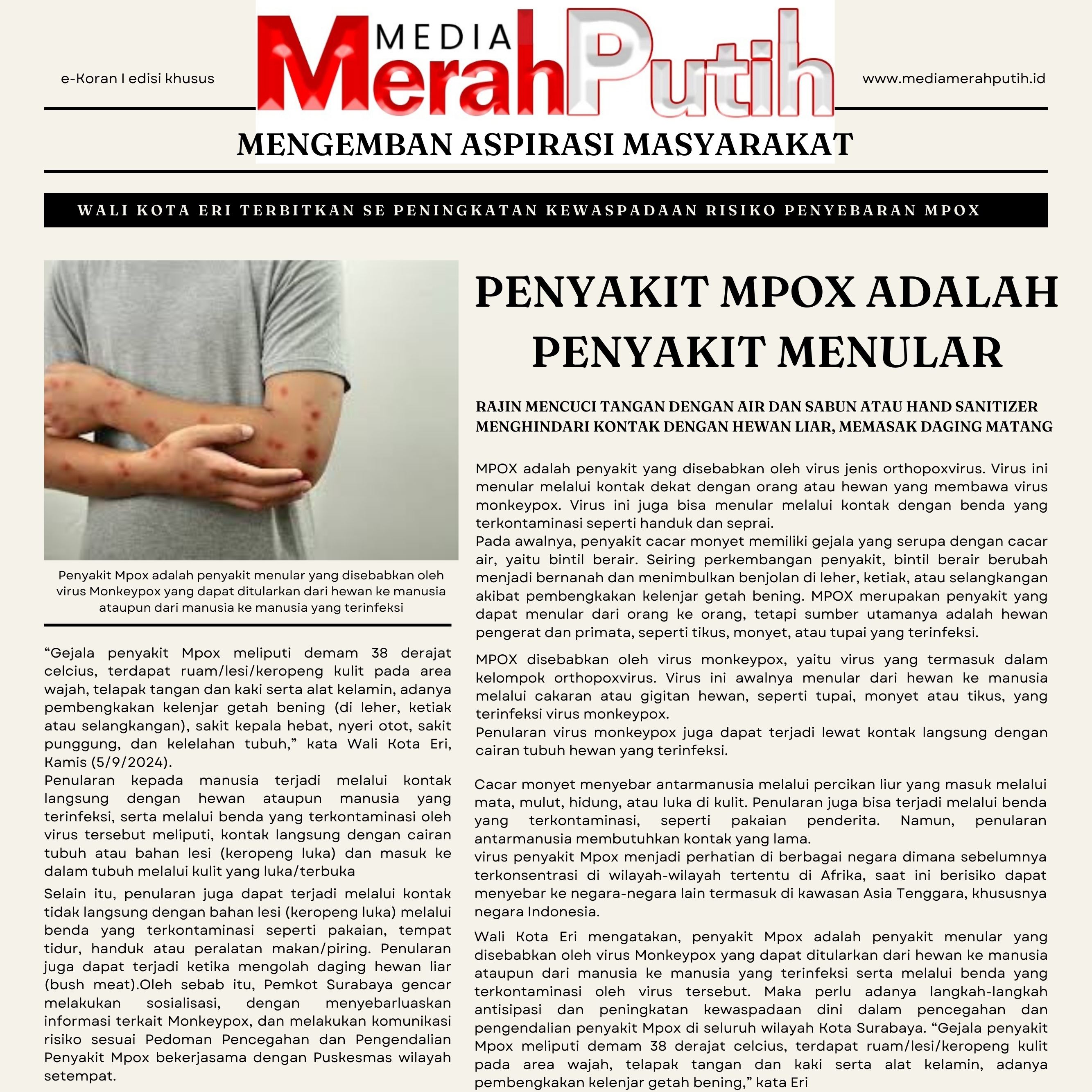 Pemkot Surabaya mengambil langkah preventif untuk memastikan masyarakat terlindungi dari potensi penularan penyakit Mpox.khususnya negara Indonesia I MMP I Grafis I Antonius Andhika 